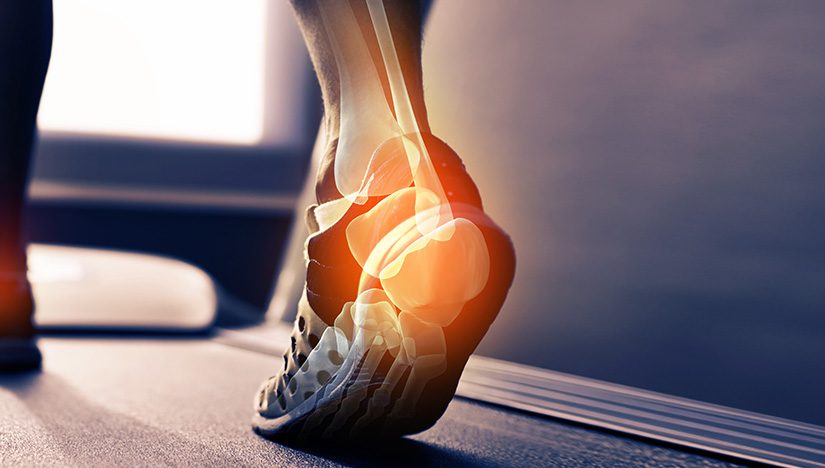 Exercise tips for diabetics and the importance of keeping your feet protected